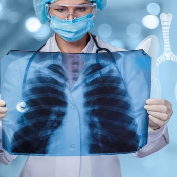 doctor with lung x-ray