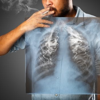 smoking lung damage